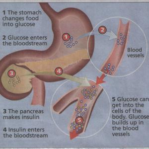 Diabetes Research Articles - Diabetes Neuropathy: Short Commentary On Indications And Treatment Plans