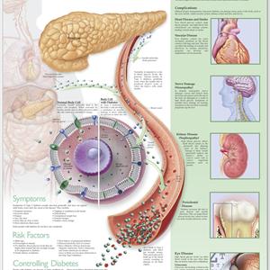 Best Diabetic Foods - Diabetes Causes And Symptoms And Alternative Home Remedies For Thr Treatment Of Blood Sugar